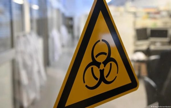 OMS monitorea muerte de investigadora en laboratorio de Rusia por sospecha de peste neumónica